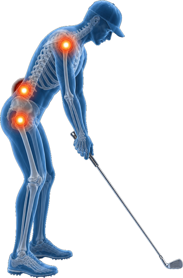 Anatomical illustration showing common recovery points for Black Desert owners, guests, and golfers